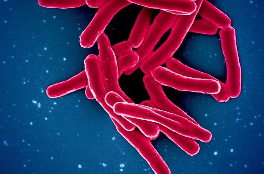 گزارش سازمان بهداشت جهانی درباره سل