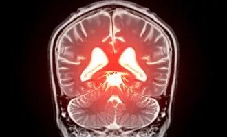 تصویری از مغز