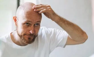 داروی جدید طاسی مردان