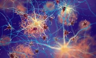 تأثیر واکسن زونا بر زوال عقل