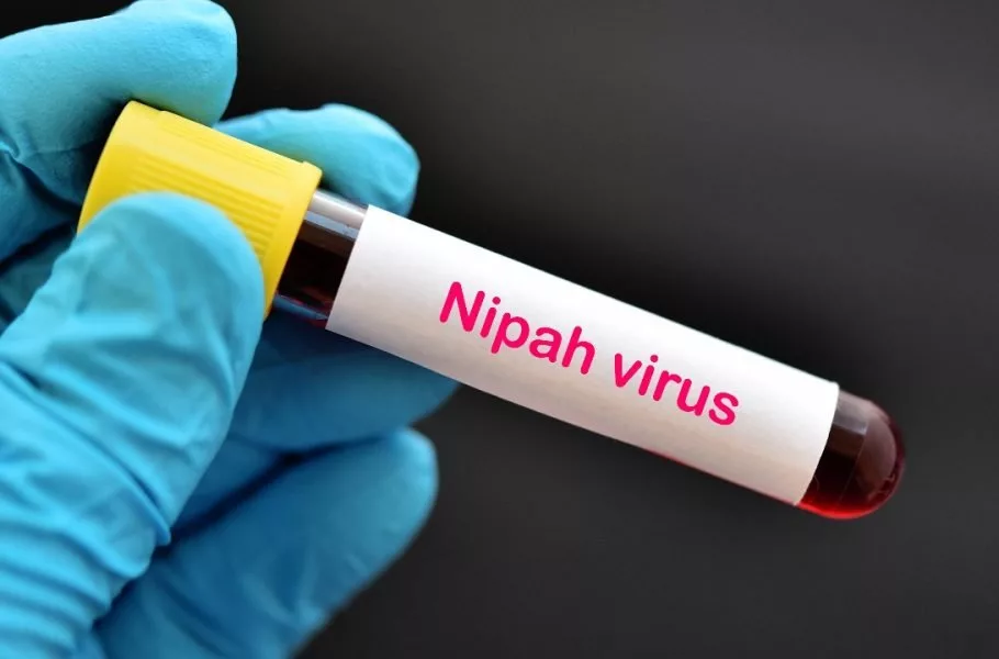 ویروس نیپا