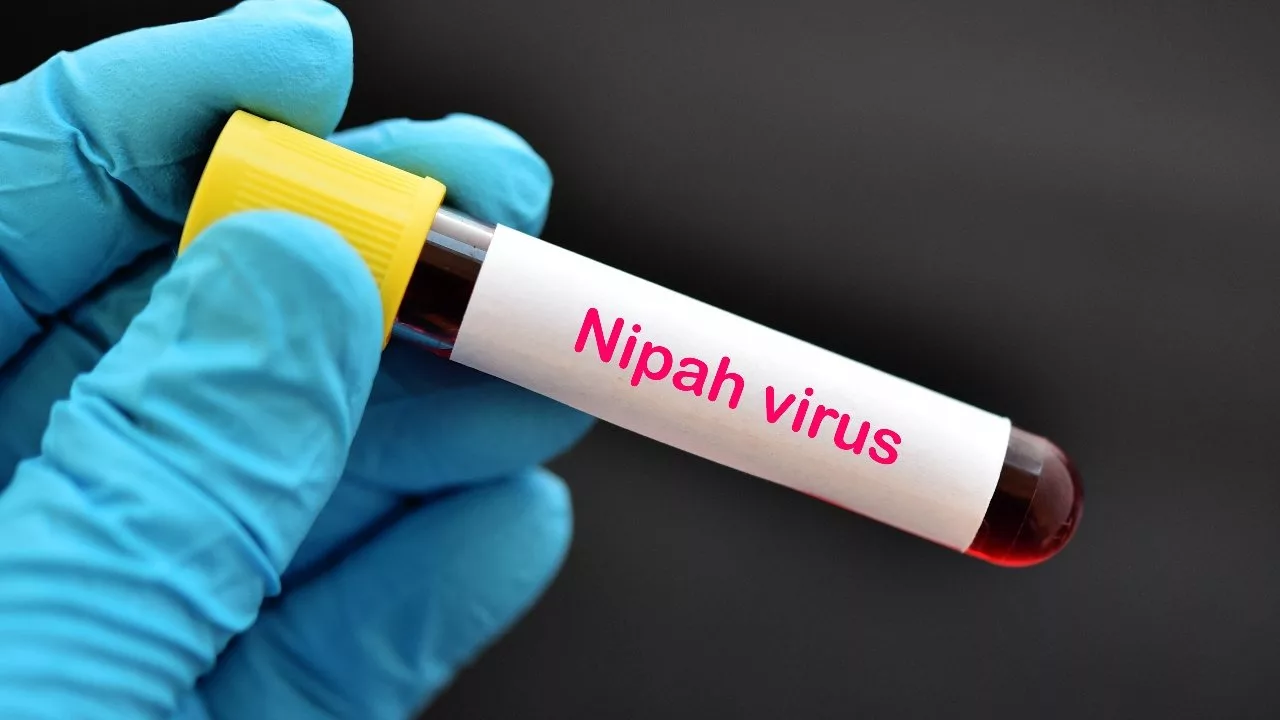 درباره ویروس خطرناک نیپا و شیوع آن در هند چه می‌دانیم؟