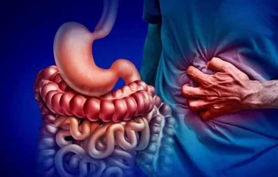 بیماری کرون