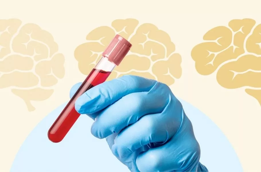 آزمایش خون آلزایمر