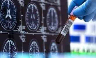 جزئیات بررسی دو دهه‌ای روی وضعیت سلامت سالمندان
