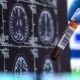 جزئیات بررسی دو دهه‌ای روی وضعیت سلامت سالمندان