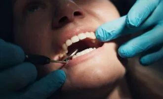 ارتباط خونریزی و تحلیل لثه با زوال عقل و آلزایمر
